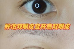 内双怎么贴双眼皮贴才能看起来更自然？有什么技巧？