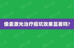 像素激光祛痘的价格大概是多少？效果如何？