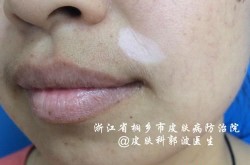 裴涩琪整容前后对比如何？她的整形经历值得参考吗？