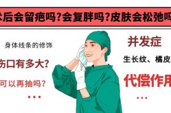 吸脂减肥效果好不好？有哪些风险和并发症？