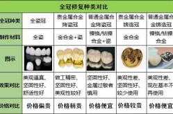 烤瓷牙种类及价格繁多，哪种更适合自己且价位适中？