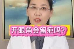 开眼角手术价格是多少？术后会不会留疤？