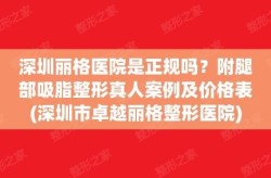 吸脂整形的价格差异大吗？决定因素是什么？