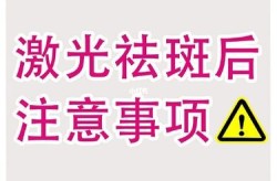 激光祛斑效果如何？术后护理要注意什么？