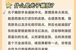 光子嫩肤医院哪家效果好？治疗周期是多久？