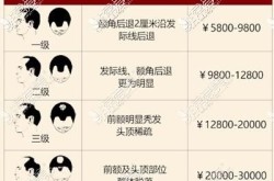 5000元预算能做植发吗？价格与效果如何？