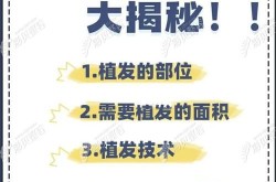 5000个毛囊植发的价格范围是多少？影响价格的因素有哪些？