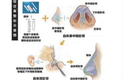 合肥105整形医院做隆鼻好吗？价格如何？