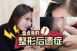 脸部整形手术风险大吗？如何降低整形风险？