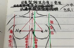 假体丰胸方法哪种好？如何选择合适的假体材料？