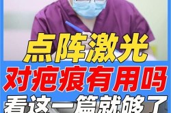 像素激光去疤效果如何？需要几次治疗？