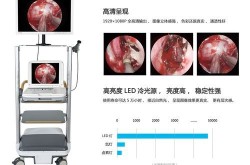 鼻内窥镜手术费用高吗？与传统手术相比有何优势？