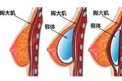 隆胸手术的费用大概是多少？手术风险有哪些？