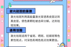 激光能去除黄褐斑吗？需要做几次才能见效？