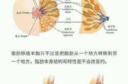 丰胸机构怎么选择？哪些技术最可靠？