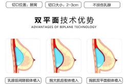 韩式三点式假体隆胸有哪些优点？