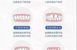 牙齿整形医院如何选择？牙齿矫正有哪些方法？