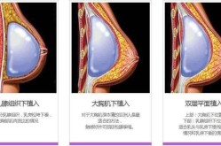 丰胸手术安全吗？手术前后需要注意什么？