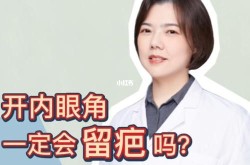 开眼角手术一般需要多少钱？手术风险高吗？