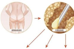 面部塑形哪种方法最有效？风险大不大？