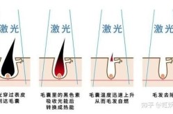 面部脱毛有哪些方法可以选择？哪个最彻底？