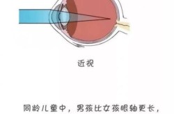 角膜塑形镜真的不适合孩子吗？原因有哪些？