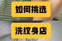 杭州哪个医院洗纹身技术最好？如何选择？