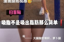 吸脂减肥塑型后如何保持效果？有秘诀吗？