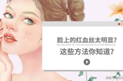 退红血丝的方法有哪些？哪种最安全有效？