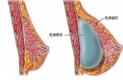 医院隆胸手术和门诊隆胸哪个更安全？