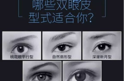 北京做双眼皮贵不贵？具体要多少钱？