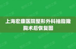 上海宏康医院妇科隆胸手术多少钱？风险与效果怎样？