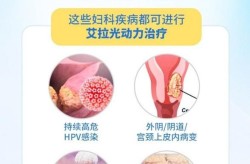 光动力治疗费用怎样计算？不同医院价格差多少？