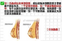 假体隆胸和自体脂肪丰胸哪个更好？专家怎么建议？