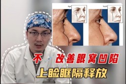 眼部吸脂费用高吗？能维持多长时间的效果？