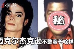 迈克尔杰克逊整容失败的原因是什么？如何避免？