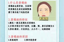 治疗黄褐斑需要多少钱？有没有快速祛斑的方法？