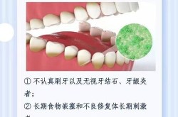 牙周炎治疗的最佳时机是什么？治疗方法有哪些？