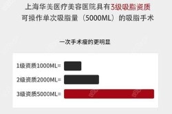 上海吸脂减肥费用大概是多少？如何选择医院？