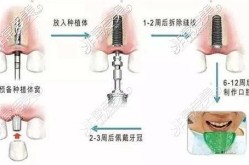 想做种植牙，哪里手术更让人放心？