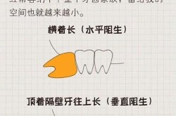 拔牙手术去哪个医院？如何降低风险？