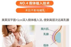 假体丰胸如何确保安全？哪些医院值得信赖？